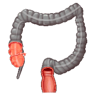 return to the large intestine