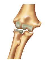 go to elbow joint disorders