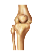 go to knee disorders